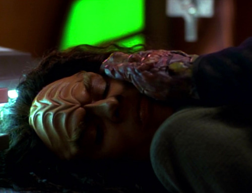 Vidiian hand on Klingon B'Elanna's face