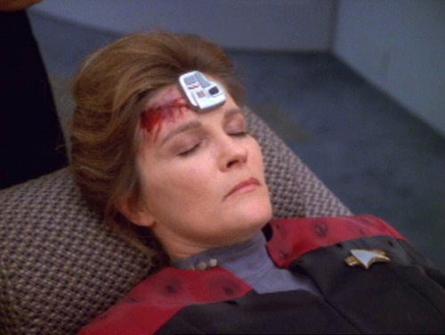 Janeway in sickbay with bloody head and cortical stimulator